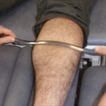 Instrument Assisted Soft Tissue Mobilization - IASTM